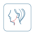 A drawing of a face with a red cerated line highlighting the neck