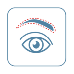 A drawing of an eye highlighting the brow above it