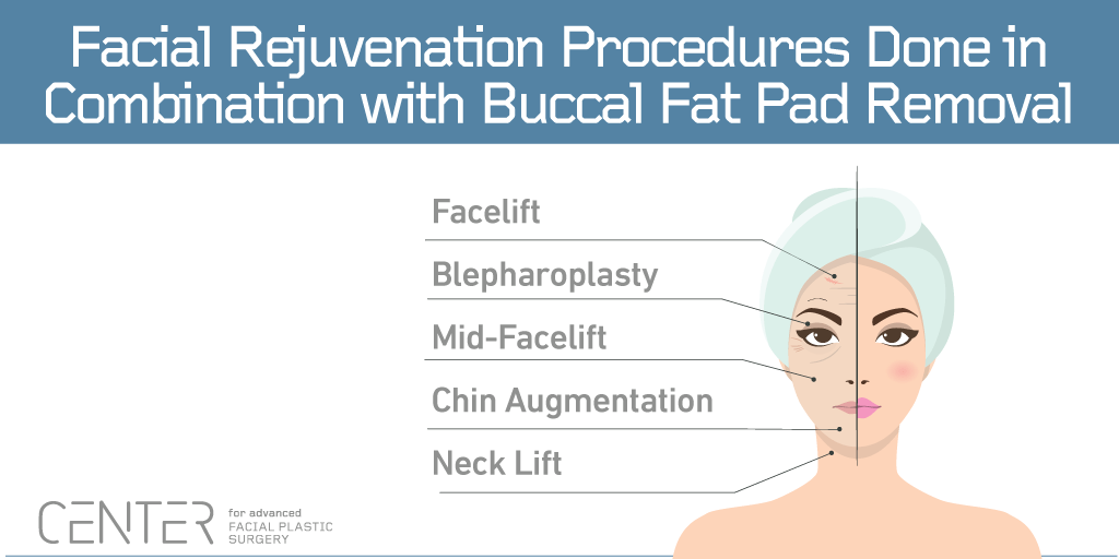 Procedure di ringiovanimento del viso fatte in combinazione con la rimozione del cuscinetto di grasso buccale