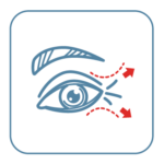 Drawing of Eye Bag Removal Surgery