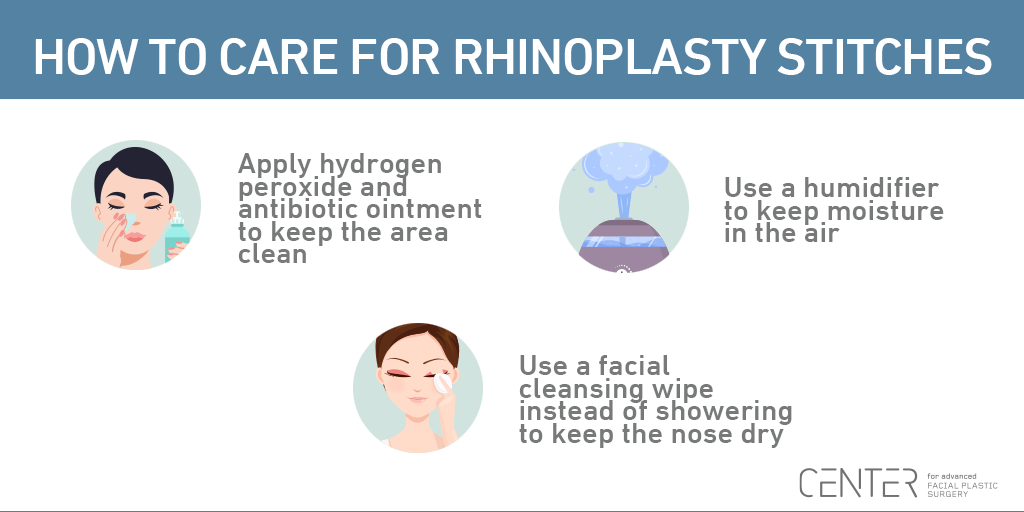 How to Care for Rhinoplasty Stitches