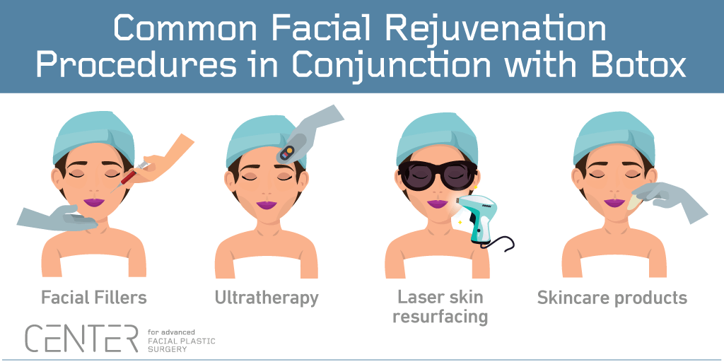 Common Facial Rejuvenation Procedures in Conjunction with Botox