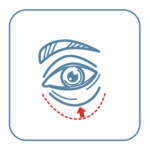 A drawing of an eye with a red arrow pointing to the skin below the eye