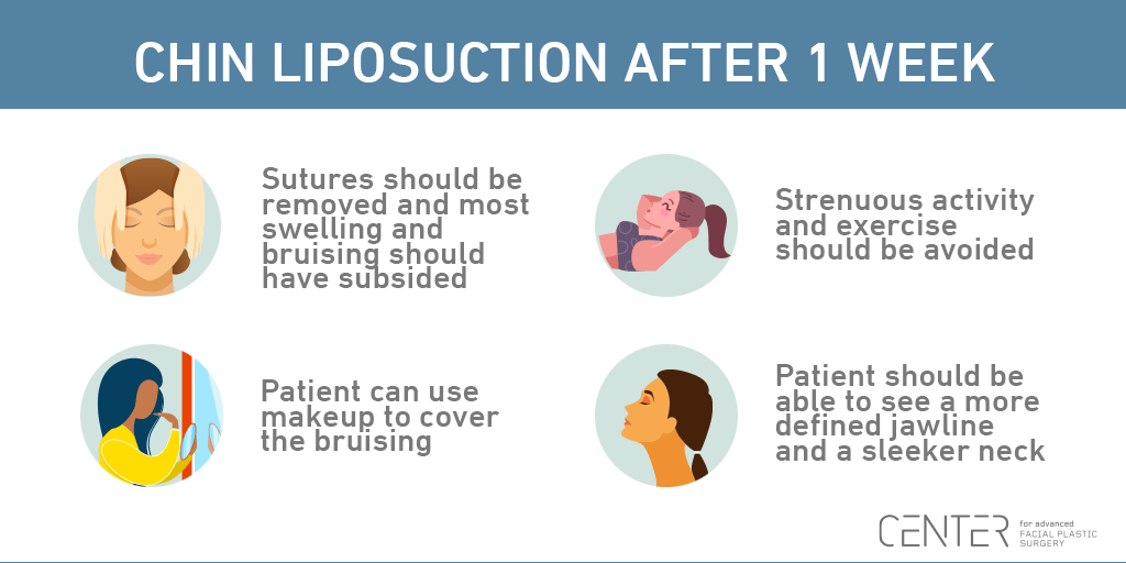 How Long to See Results from Chin Liposuction - CENTER for Advanced