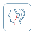 A drawing of a face with a red cerated line highlighting the neck