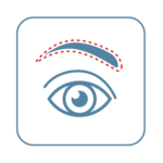 A drawing of an eye highlighting the brow above it
