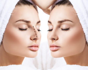 The Difference Between Open and Closed Rhinoplasty