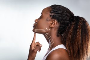 animated lines showing the direction that skin will be pulled after facelift and neck lift